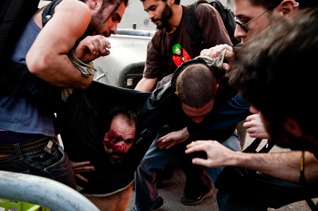 Protesters wounded by rubber bullets during the general strike, Barcelona. Photo Jesús G. Pastor, copyright Demotix 3/29/12.