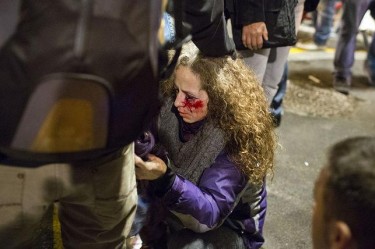 Barcelona: mulher ferida que poderá vir a perder um olho. Fotografia da página de Facebook «AntenapezTV»