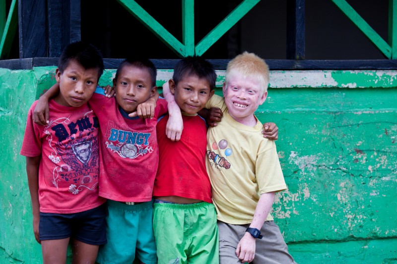 Niños guna, incluido un niño albino. Foto en Flickr del usuario Ben Kucinski (CC BY 2.0).